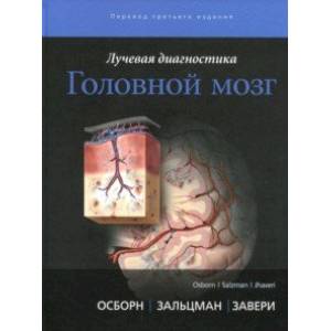 Лучевая диагностика. Головной мозг