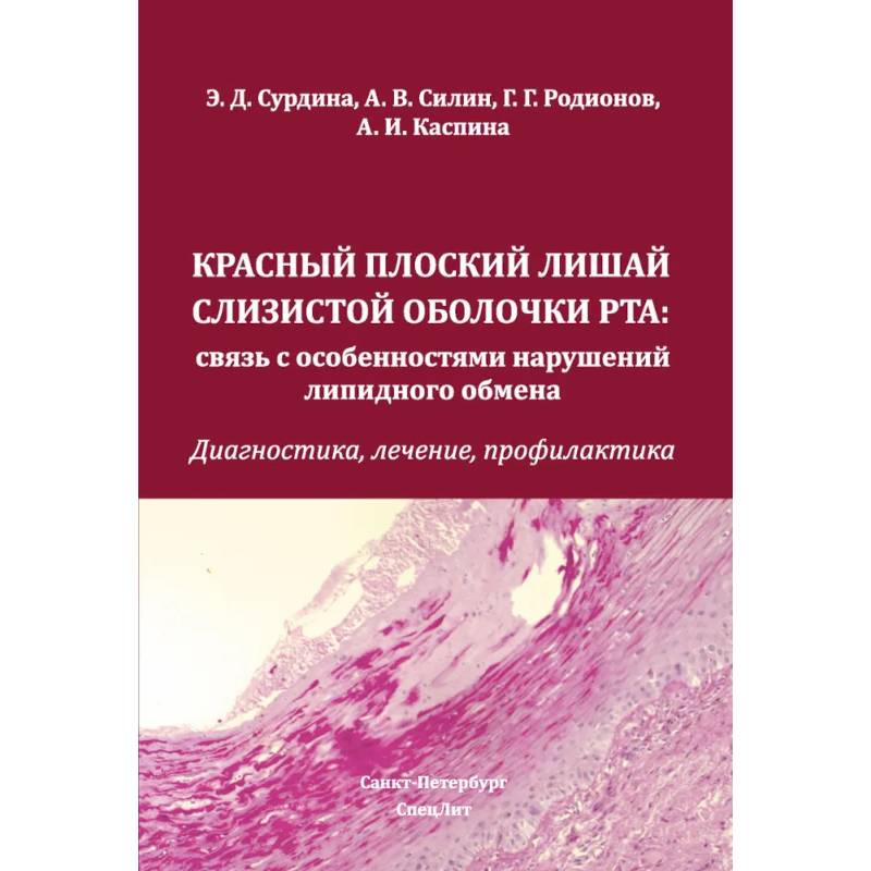 Красный плоский лишай слизистой оболочки рта: связь с особенностями нарушений липидного обмена. Диагностика, лечение, профилактика