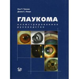 Глаукома. Иллюстрированное руководство