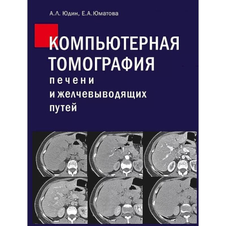 УЗИ. ЭКГ. Томография. Рентген, книга Компьютерная томография печени и желчевыводящих путей: практическое руководство купить по скидке