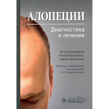 Алопеции.Диагностика и лечение