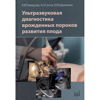 Ультразвуковая диагностика врожденных пороков развития плода
